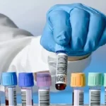 Lab Diagnostic